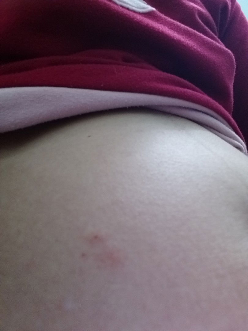 Dị ứng hay lý do gì khác?