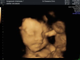 Wipawee Khongsawat profile icon