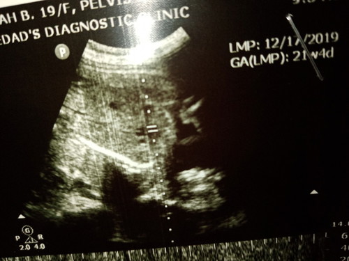 Ultrasound