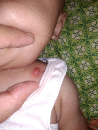 kata dokter cuma biang keringat