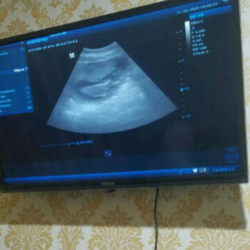 berat janin 3 bulan berapa?