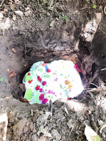 เด็กแฝด6เดือนที่ไม่มีพุงโชว์แล้ว