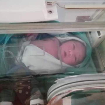 ความดันสูงจนต้องผ่าคลอด