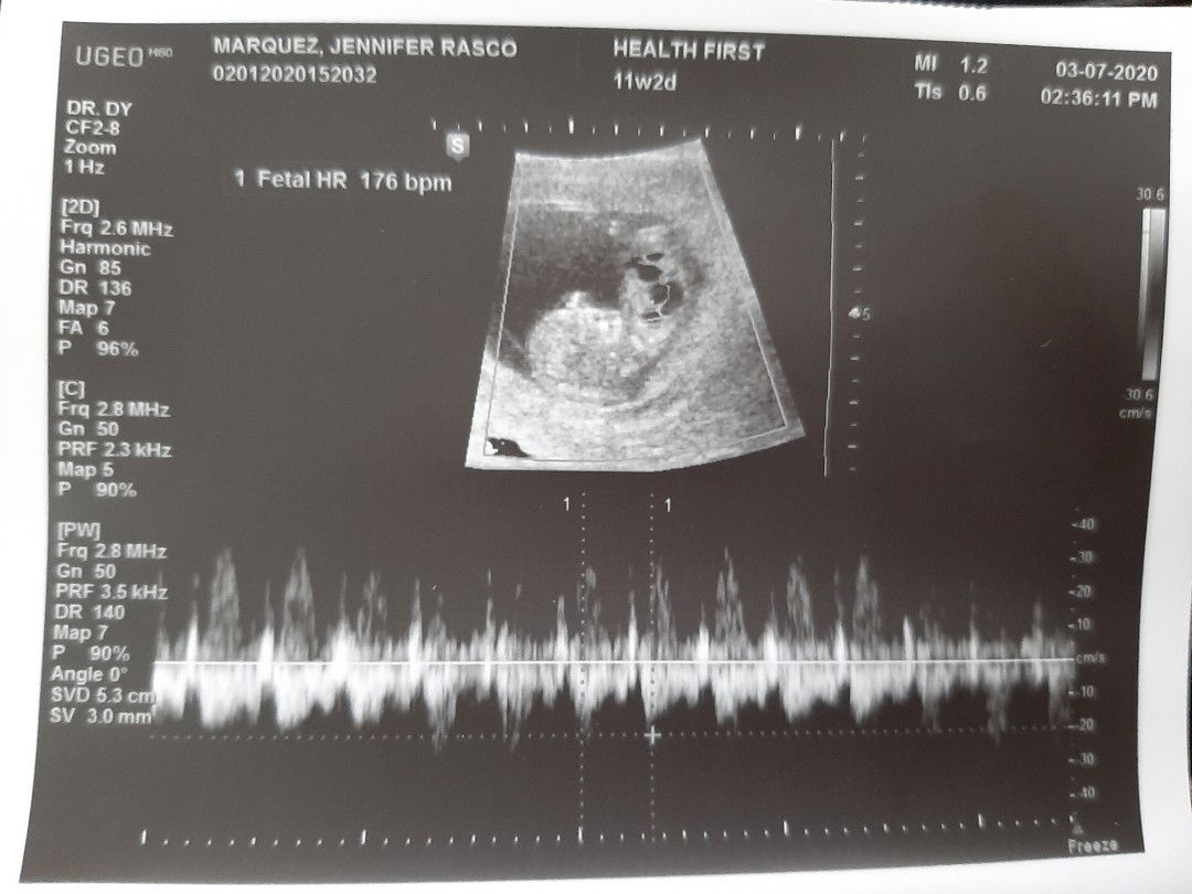 Soon To Be a Mommy ♥️ profile icon