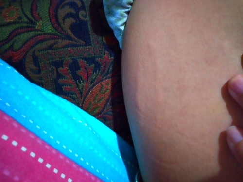 10weeks Pregnant