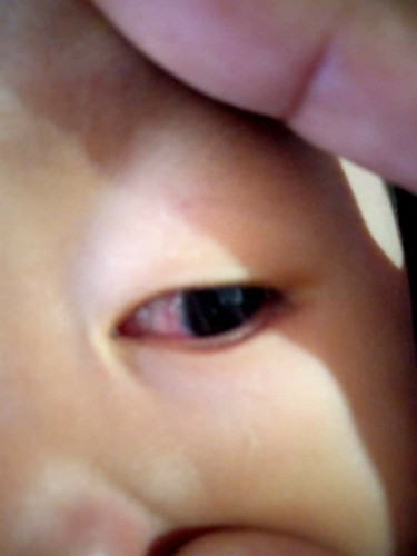 ถามแม่ๆหน่อยค่ะ.