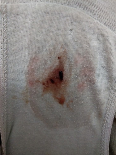 blood