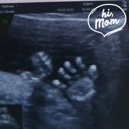 ทักทายแม่ๆจ้า #20weeks