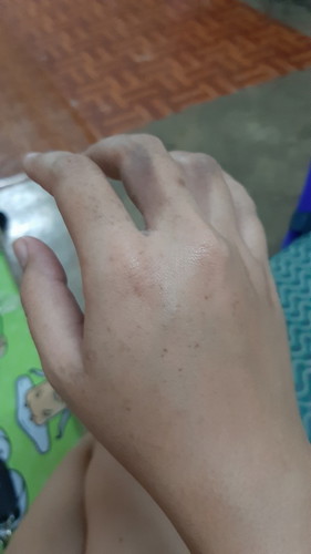 โดนไฟดูด