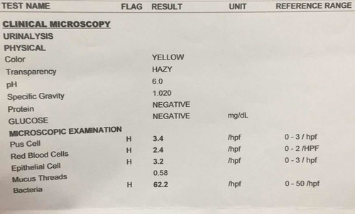 Urinalysis result