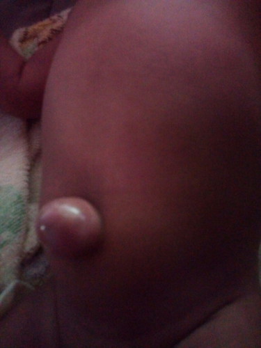 ลูกน้อย