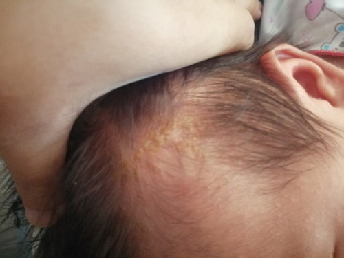 แม่ๆค่ะทำไงดี