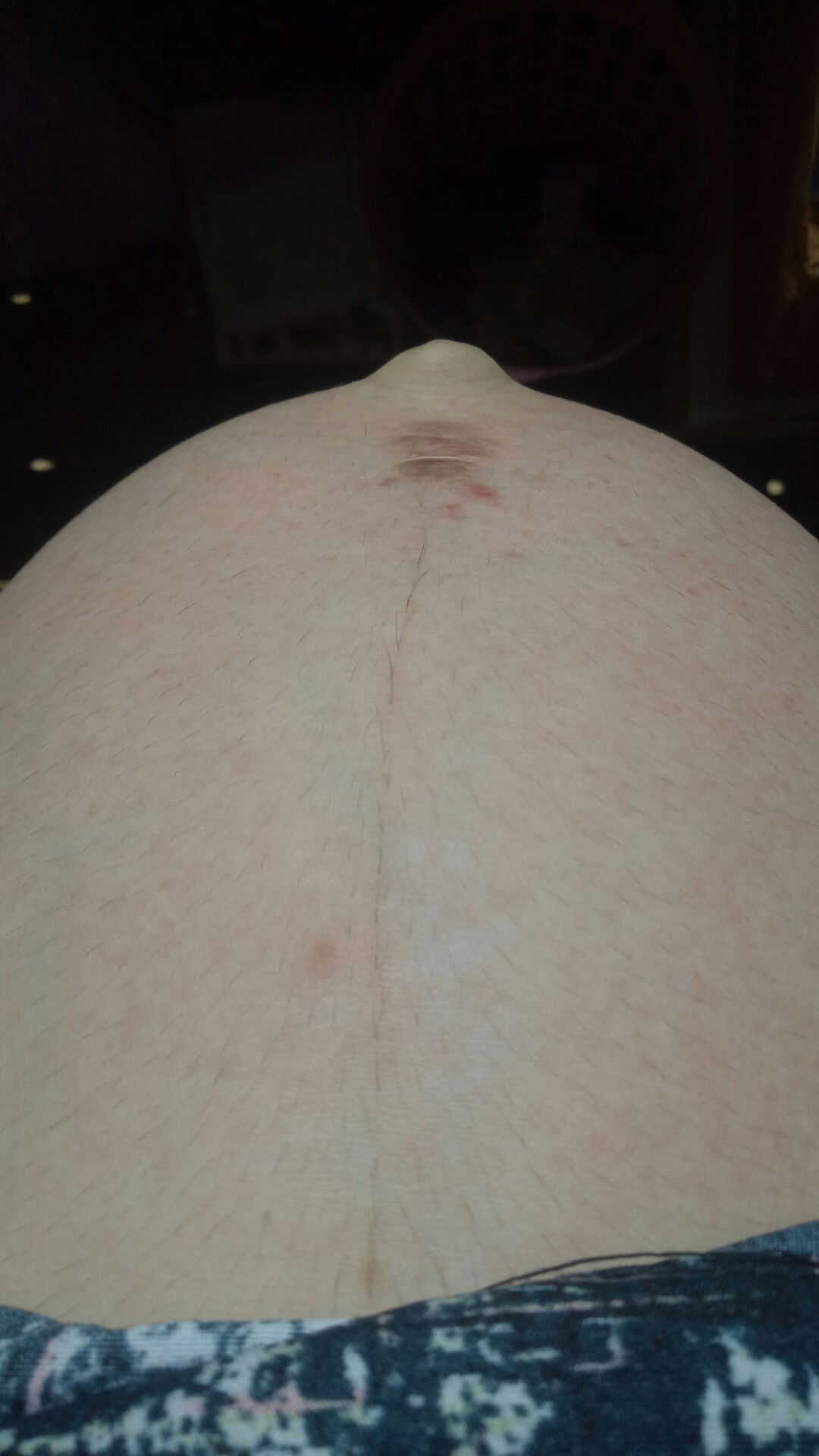 เป็นแบบนี้ปกติไหมคะ