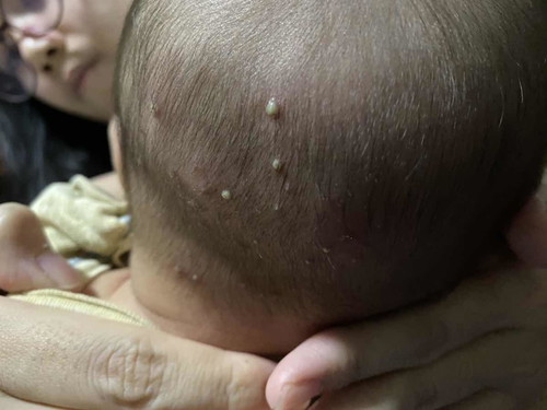 อยากทราบว่าลูกเป็นอะไร