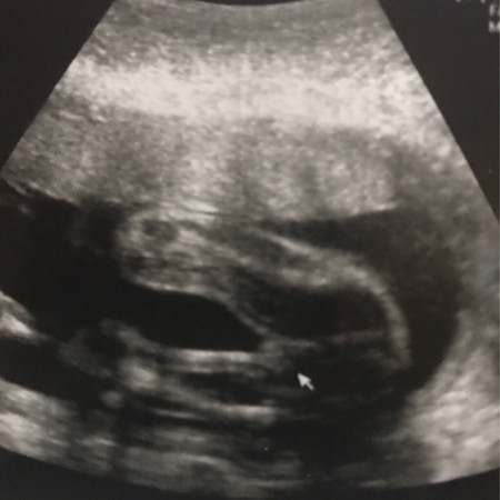 ผู้หญิงหรือผู้ชายค่ะ แม่ๆช่วยดูหน่อยค่ะ