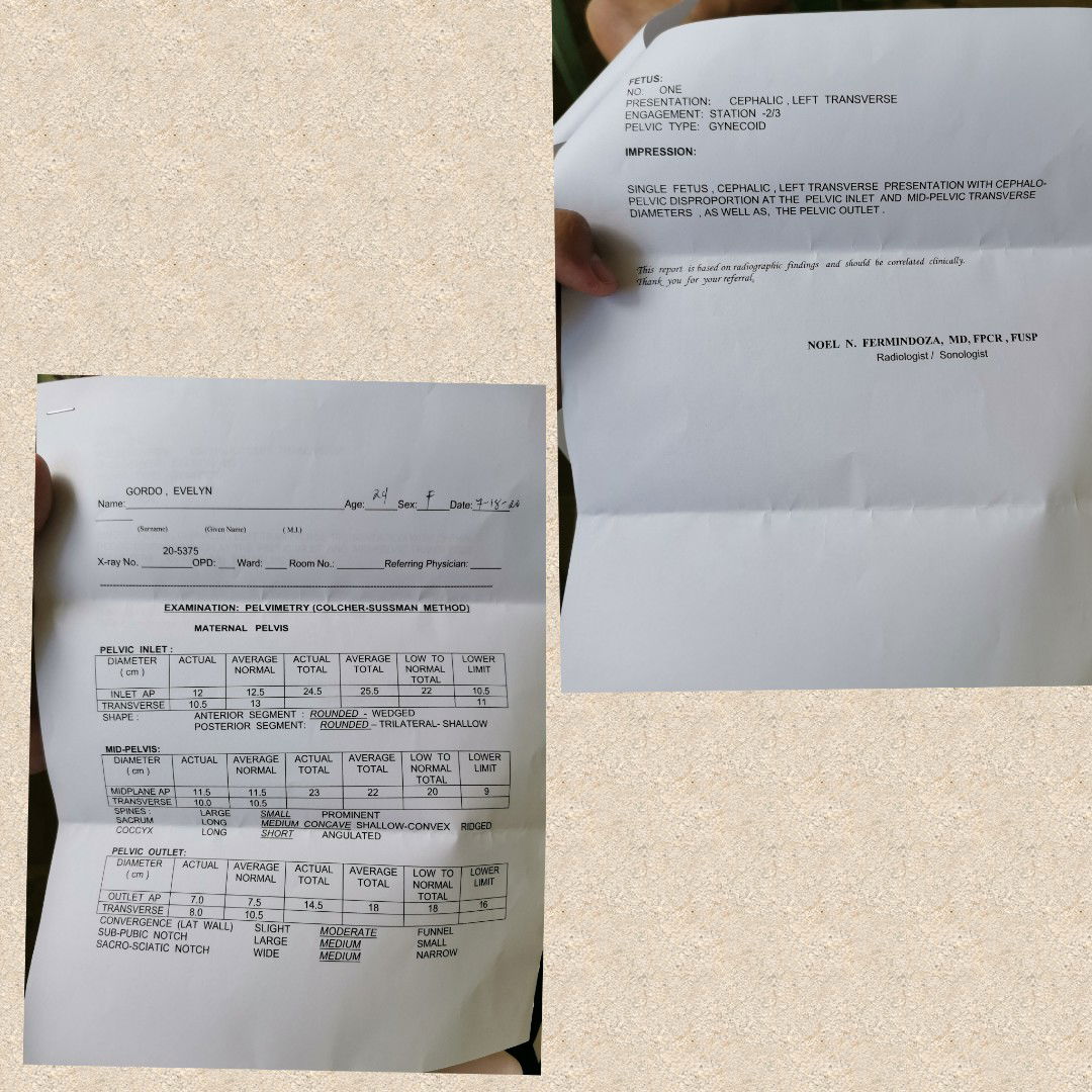 Hi Mommies Pelvic Xray Result