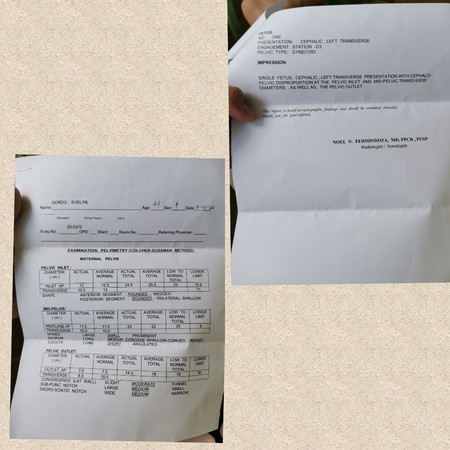 Hi Mommies Pelvic Xray Result