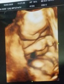 Imma Umiarsih profile icon