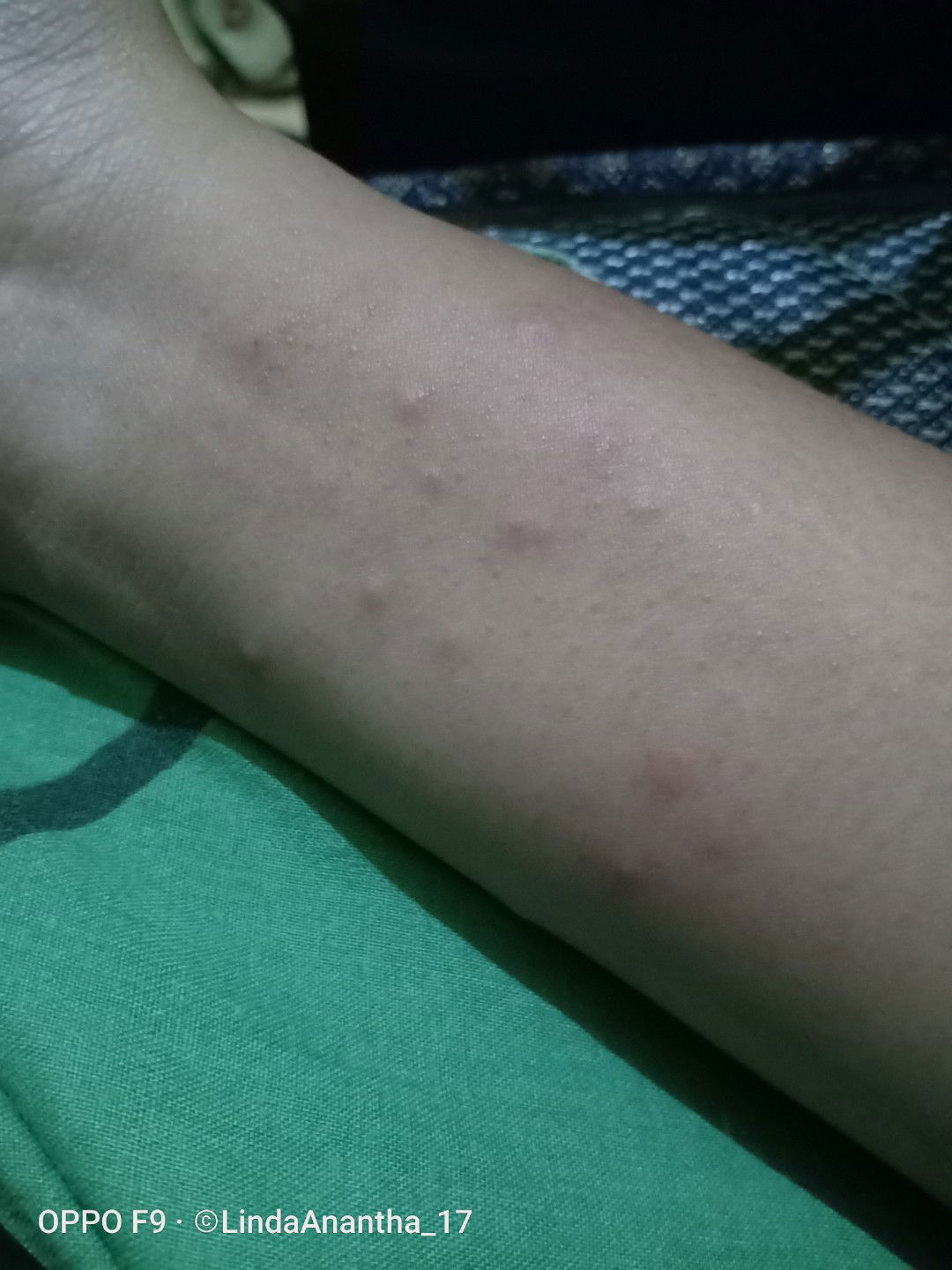 alergi atau bawaan bayi ?