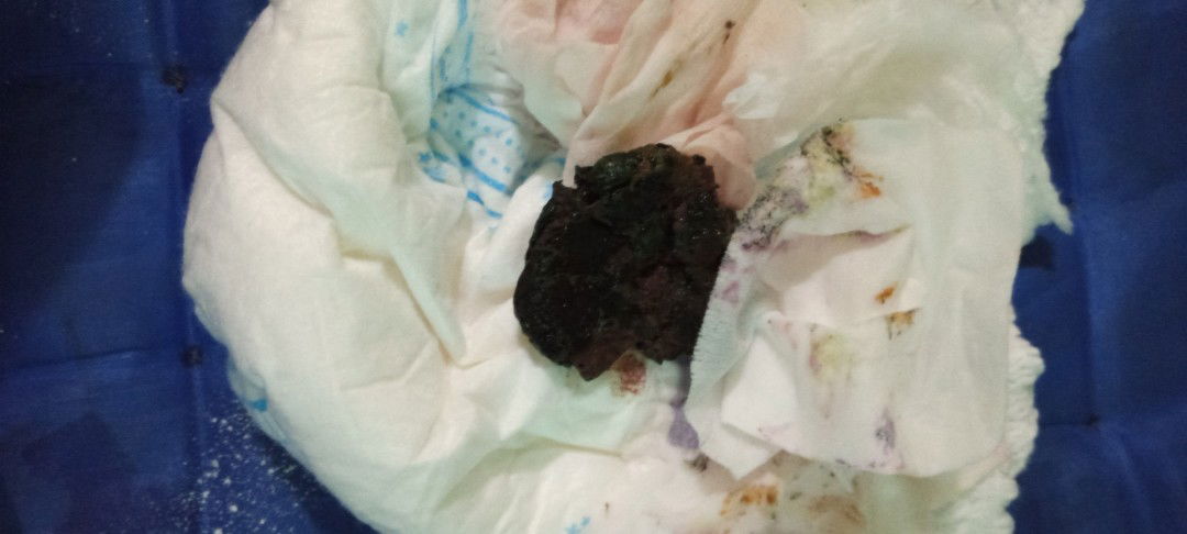poop bayi hitam