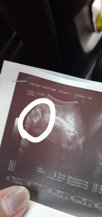 ขอถามคุณแม่หน่อยจ้า