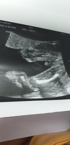 ada sesiapa boleh teka jantina anak sy?