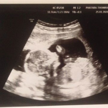 Navarut Fongrid profile icon