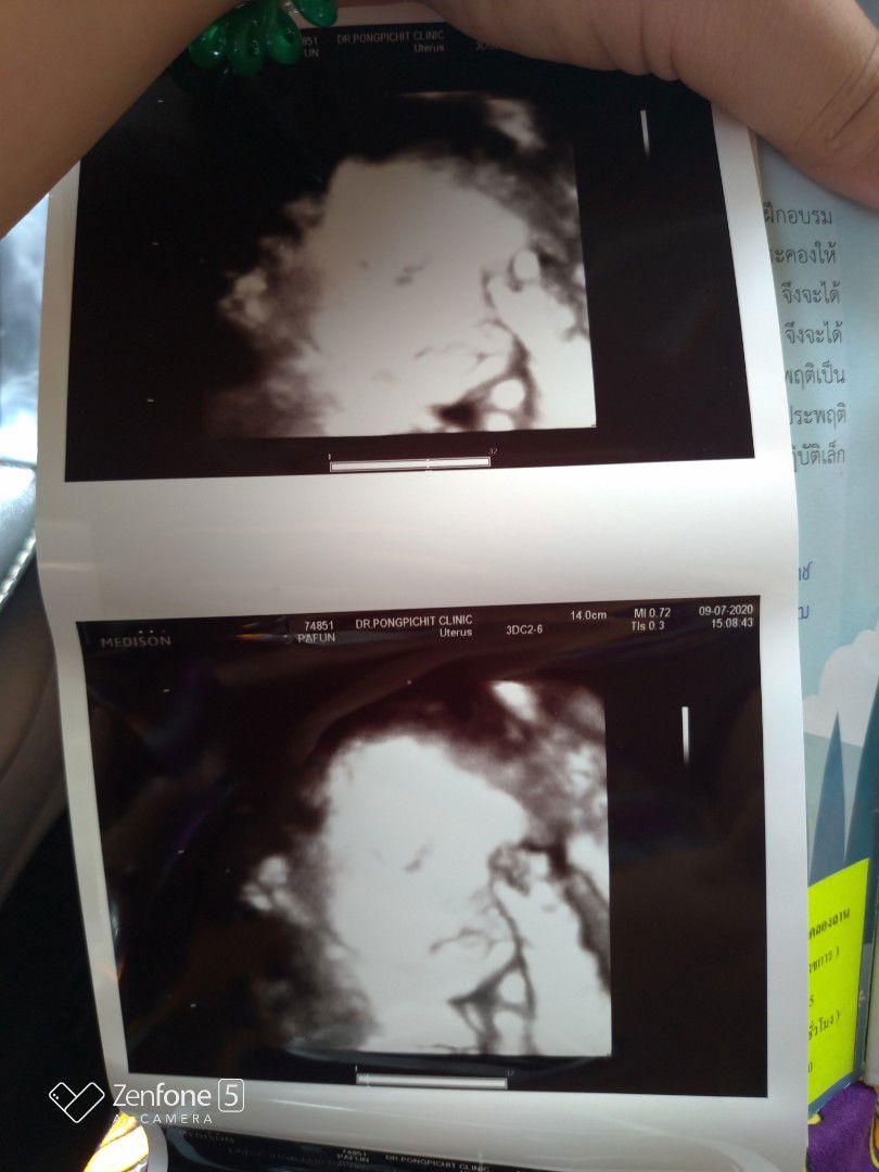 ช่วยดูรูปตรงปากน้องหน่อยค่ะว่าปกติไหม