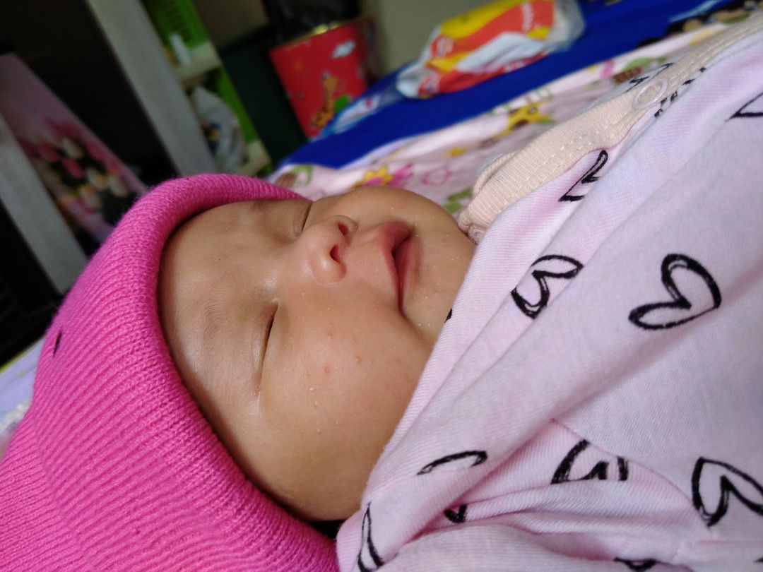 Bentusan disekitar muka