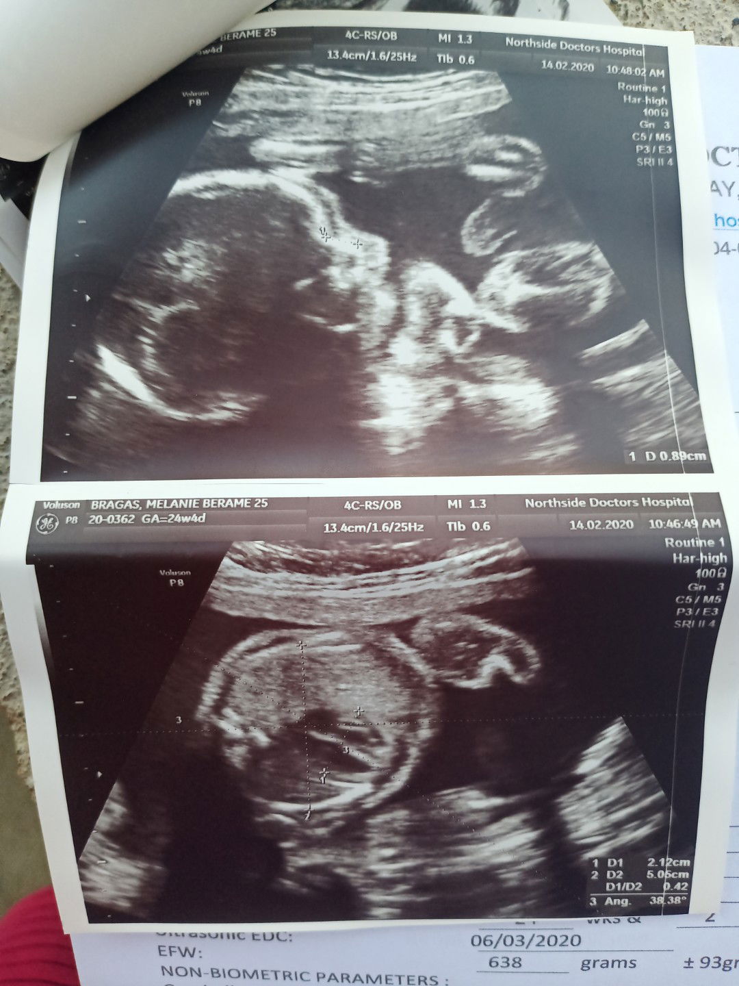 Melanie Berame Bragas profile icon