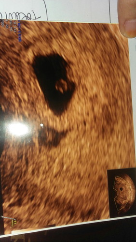 sudah berapa umur kandungan?