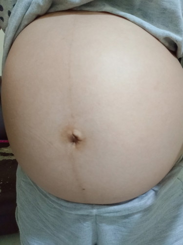 28 wks and day 1