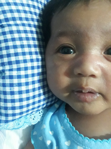 bibir bayi kering dan pecah2?? ?