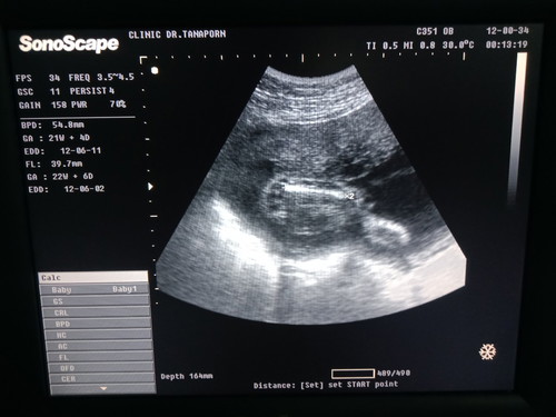 ดูน้ำหนัก