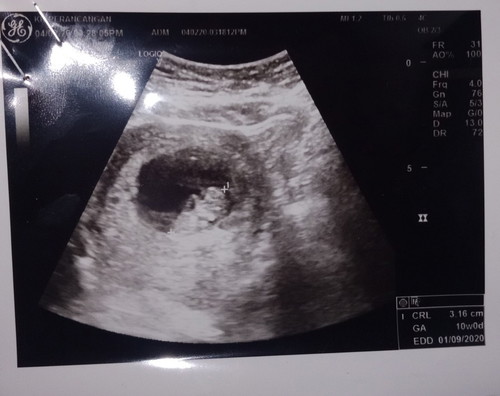 my baby 2020