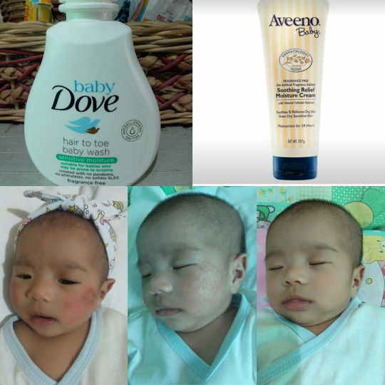 for rash baby..dove soap fregrance free and Aveeno cream baby?