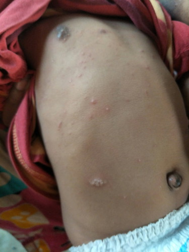 น้องแพ้อะไร