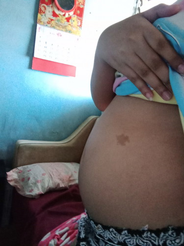 Baby Bump