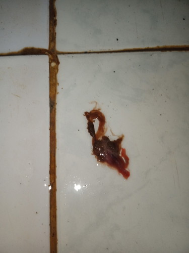 Buo na Dugo