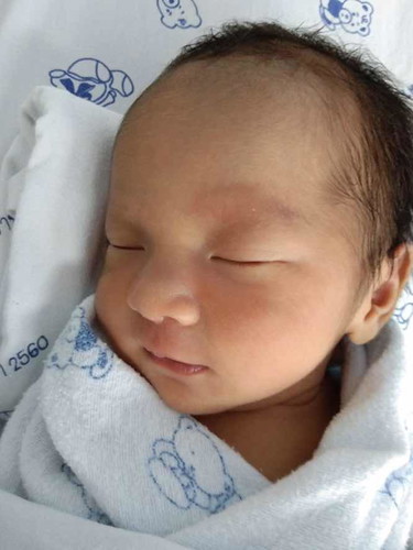 คลอดก่อนกำหนด