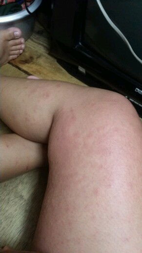 Dermatologist please ?