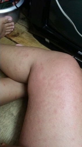 Dermatologist please ?