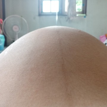 ท้องแบบนี้เป็นอะไร