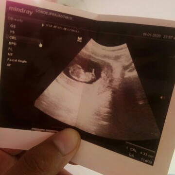13week จร้า
