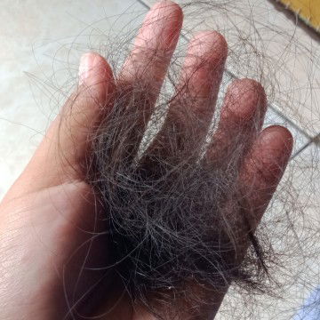 rambut rontok