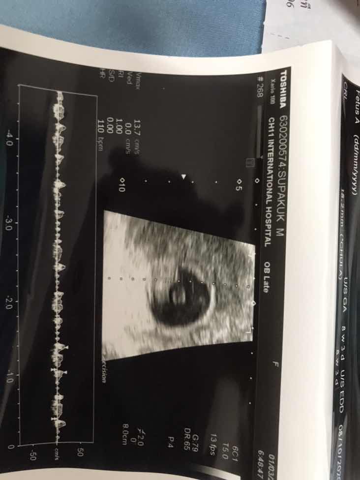 ขอคำแนะนำ