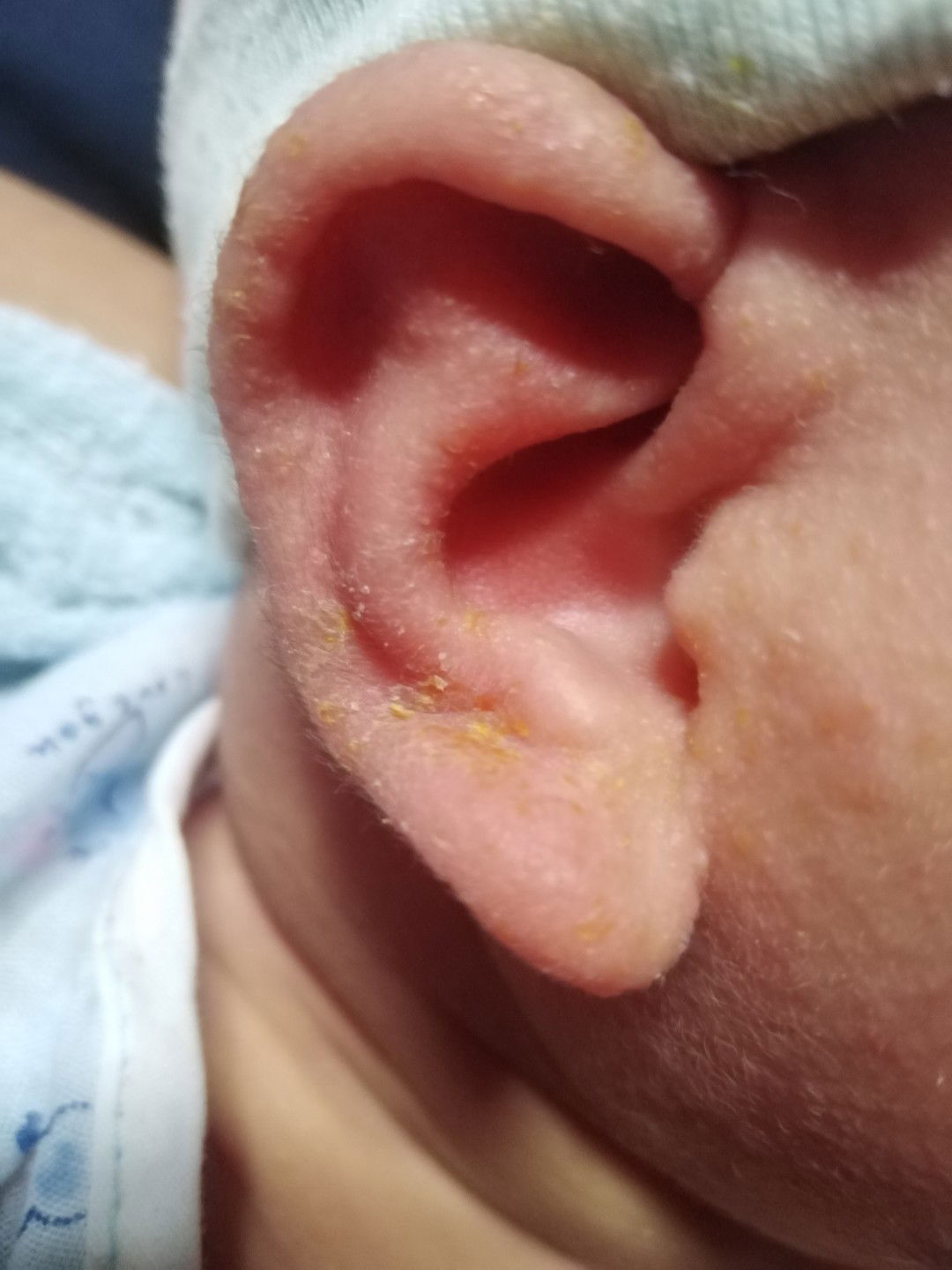 ตรงหูน้องเป็น