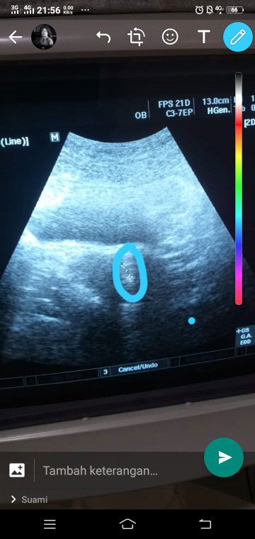 ga paham gambar usg