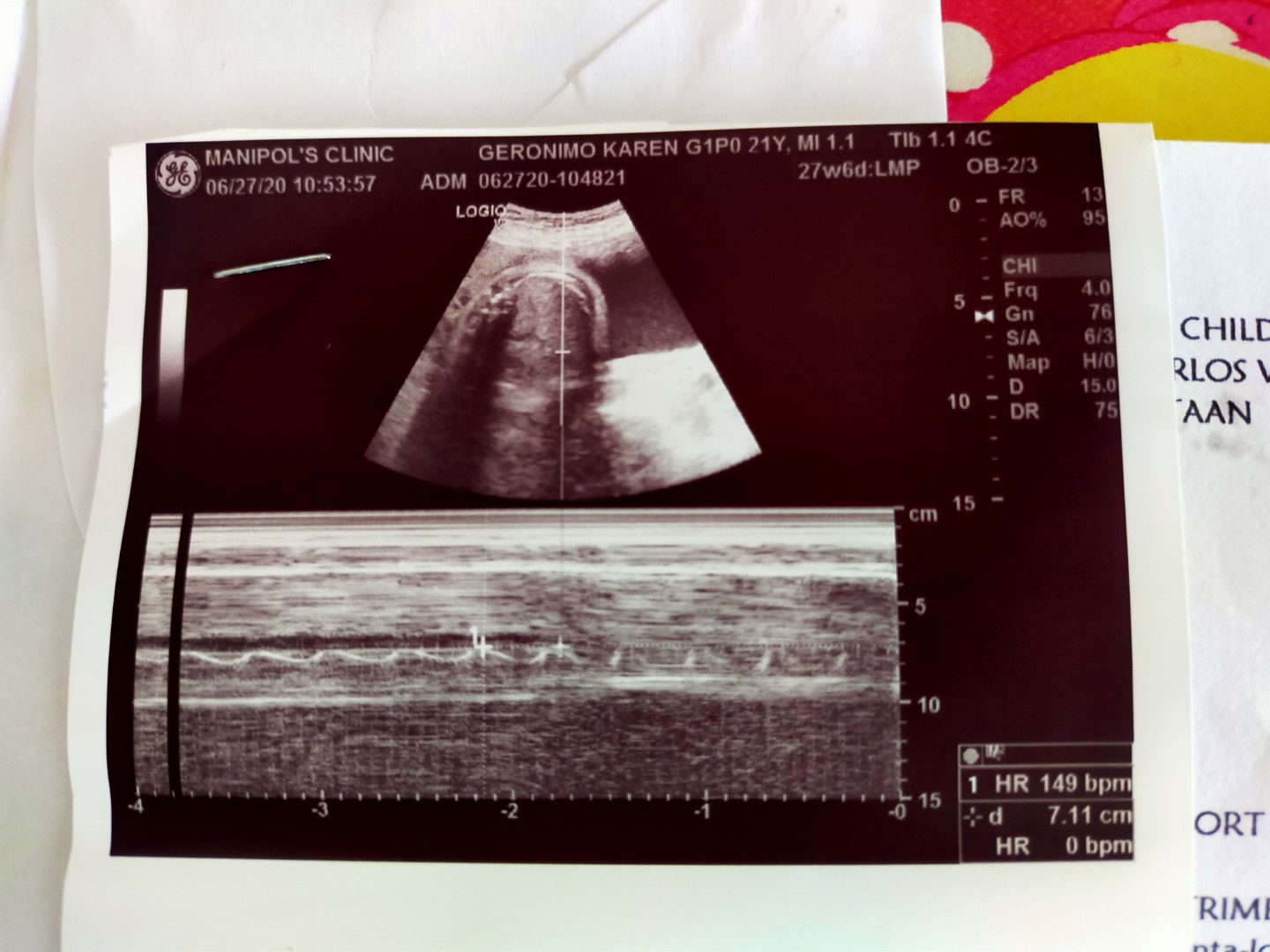Hello po, First mom here! 😅 Ask lang po ano ponkaya sa tingin nyo gender ni baby ko? ayaw po kasi magpakita ni baby 😅  #29wks6d 👶