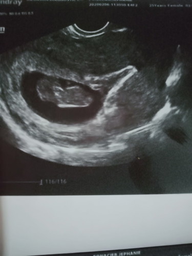 my 2nd baby
